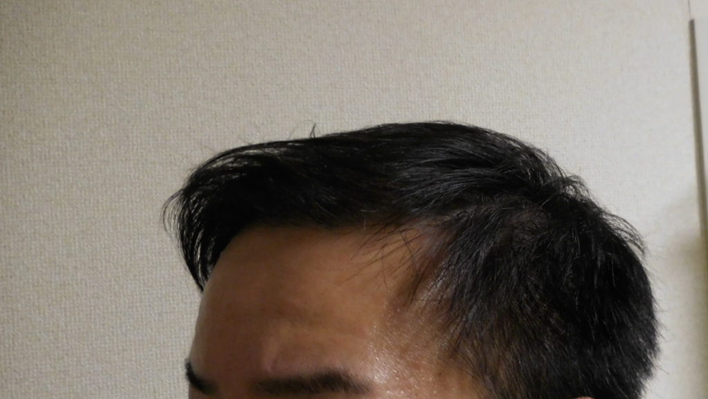 薄毛 夕方になるとヘアスタイルが崩れてしまう時の対策 クレンジングオイルで解消する方法 男のハゲ対策 Bigoran ビゴラン