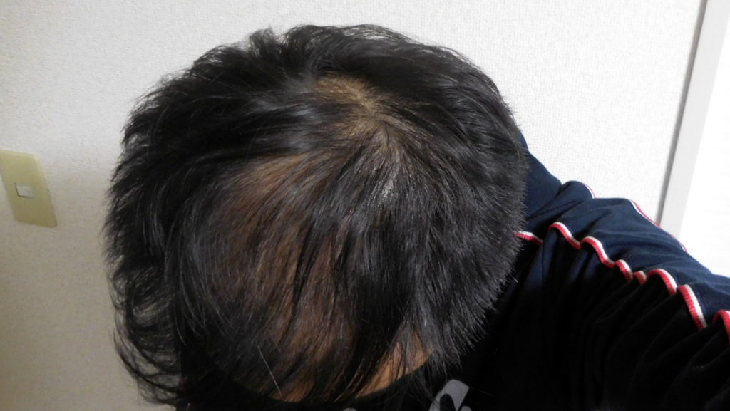 薄毛の男性は 椿油 ヘアオイル で髪の毛をボリュームアップできる ハゲ隠しに最適 Bigoran ビゴラン